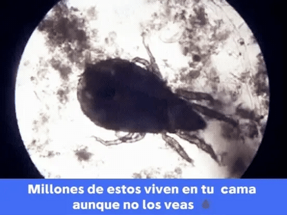 ASPIRADORA DE ACAROS DELUXE